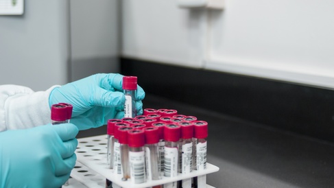 Genetic analysis 