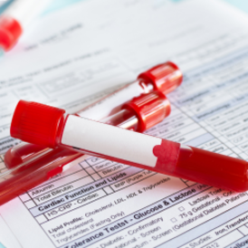 Genetic analysis
