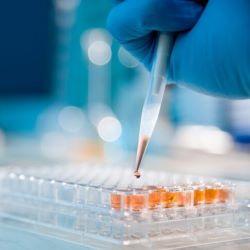 pipette